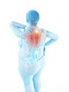 Womans painful upper back