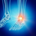 A painful ankle Royalty Free Stock Photo