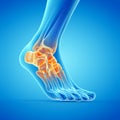 A painful ankle Royalty Free Stock Photo