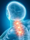 A painful cervical spine Royalty Free Stock Photo