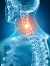 A painful cervical spine Royalty Free Stock Photo