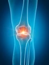 A painful knee Royalty Free Stock Photo