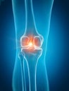 A painful knee Royalty Free Stock Photo