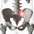 a painful sacrum joint