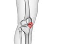 The patella bone