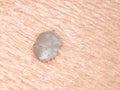 A scabies mite