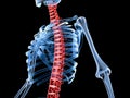 3d rendered medically accurate illustration of a skeleton with painful back spine