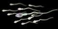 The sperm anatomy