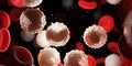 Too many white blood cells due to leukemia Royalty Free Stock Photo