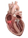 The tricuspid valve