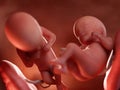 Twin fetuses - week 26