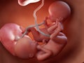 Twin fetuses - week 20 Royalty Free Stock Photo