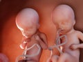 Twin fetuses - week 25 Royalty Free Stock Photo