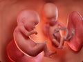 Twin fetuses - week 18