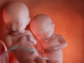 Twin fetuses - week 31