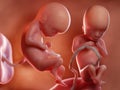 Twin fetuses - week 17