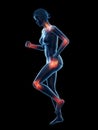 Painful joints while walking