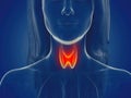 A womans thyroid gland