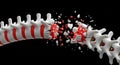 3D Rendering of a Damaged Human Spine with Exploding Vertebrae and Discs image photo Royalty Free Stock Photo