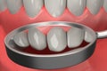 3D rendering from a dental check with a stomatoscope after brace remove
