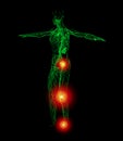 3D rendering illustration of lymphatic system Royalty Free Stock Photo