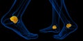 3d rendering of the malleolus bone Royalty Free Stock Photo