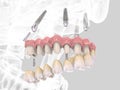 3D rendering teeth Royalty Free Stock Photo
