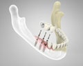 3D rendering teeth Royalty Free Stock Photo