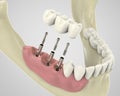 3D rendering teeth Royalty Free Stock Photo