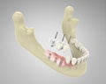 3D rendering teeth