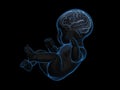 x-ray image of baby with a brain inside. Royalty Free Stock Photo