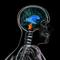 Enlargement of the fourth brain ventricle, 3D illustration