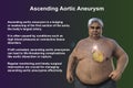 A 3D scientific illustration of a senior obese man with transparent skin revealing an ascending aortic aneurysm