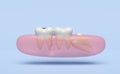 3d wisdom teeth model problems icon with gums isolated on blue background. dental examination of the dentist, health of white Royalty Free Stock Photo