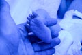 Dad holds legs in the palms of her hands. Newborn child baby having a treatment for jaundice under ultraviolet light in Royalty Free Stock Photo