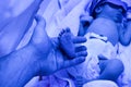 Dad holds legs in the palms of her hands. Newborn child baby having a treatment for jaundice under ultraviolet light in incubator Royalty Free Stock Photo