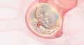 Damaged and malfunctioning mitral valve