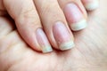 Damaged nails that have problem after doing manicure. Health and beauty problem
