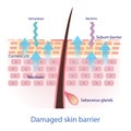 Damaged skin barrier vector on white background. Royalty Free Stock Photo