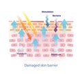 Structure of damaged skin barrier vector illustration isolated on white background. Royalty Free Stock Photo