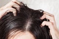 Dander that causes itching scalp