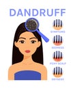 Dandruff on Hair. Scalp Disease and Beautiful Woman. Magnifying Blass and Close up view of Dandruff. Icons of Symptoms: Dryness, Royalty Free Stock Photo