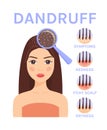 Dandruff and Magnifying Glass on the Head of pretty Woman.Disease and Treatment of the Scalp and Hair.Symptoms of dandruff.Flat