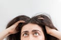 Dandruff, pediculosis and seborrhea. A close-up portrait of a young Caucasian woman, a brunette, who scratches her head with her