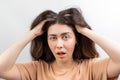 Dandruff, pediculosis and seborrhea. Portrait of a young Caucasian woman, a brunette in a beige t-shirt, who scratches her head