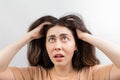 Dandruff, pediculosis and seborrhea. Portrait of a young Caucasian woman, a brunette in a beige t-shirt, who scratches her head