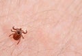 Danger of tick bite. Mite on the skin. Royalty Free Stock Photo