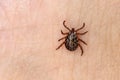 dangerous blood-sucking insect. small brown spotted mite, biological name Dermacentor marginatus on human skin. Tick on the skin Royalty Free Stock Photo