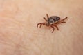 dangerous blood-sucking insect. small brown spotted mite, biological name Dermacentor marginatus on human skin. Tick on Royalty Free Stock Photo