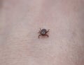 dangerous contagious insect intensity a tick crawling on human skin Royalty Free Stock Photo